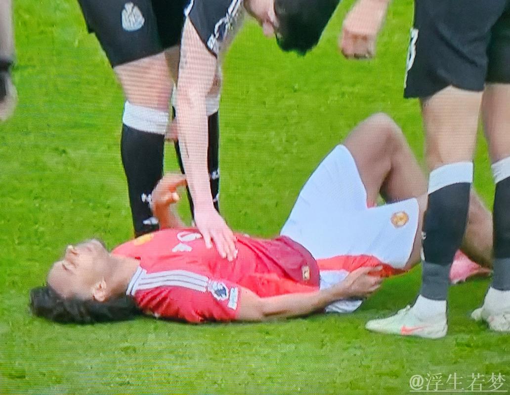 齐尔克泽伤缺至少半月,曼联或有6人缺席战里昂,阿马德已重返训练! 齐尔克泽伤缺至少半月,曼联或有6人缺席战里昂,阿马德已重返训练!